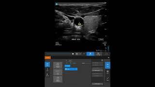 Sonosite ST: Annotating Images