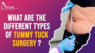 What are the different types of tummy tuck surgery? Types of Abdominoplasty