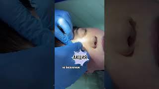 Акция #гармония #доктор  #хирург  #родинки