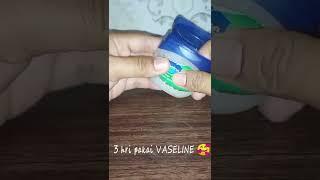 EKSIM...garuk sana garuk sini akhirnya ketemu VASELINE ||  #shorts