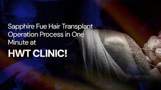 Sapphire Fue Hair Transplant Operation Process in One Minute at HWT CLINIC!