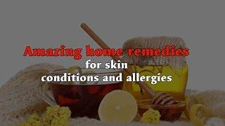 Amazing home remedies for skin conditions and allergies - Onlymyhealth.com