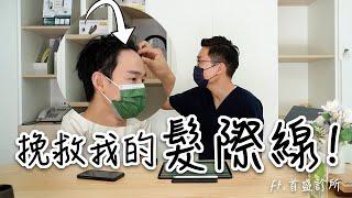 原來我有雄性禿⁉│ 挽救髮際線！一次搞懂落髮/生髮/植髮 ft.  @shawsonclinic