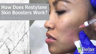 How do Restylane Skin Boosters work?