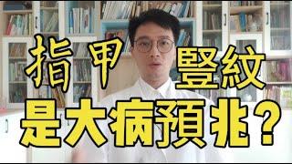 指甲上出現竪紋是大病預兆！多吃它，把體內肝臟“毒素”排出來，別太晚知道！遠離肝病，肝臟越來越健康