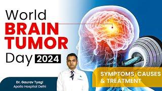 Understanding Brain Tumors: Treatment with Zap-X | Dr. Gaurav Tyagi