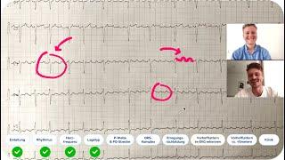 EKG befunden: Echtes EKG-Fallbeispiel mit ärztlicher Auswertung - Kommst du auf die Diagnose?