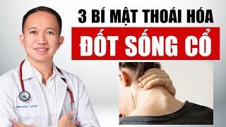 3 bí mật thoái hóa đốt sống cổ mà ít ai biết | Bác Sĩ Trần Minh