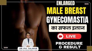 Man Boobs Surgery Procedure & Before-After Results | Male Breast Reduction In Delhi | Dr  PK Talwar