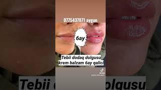 tebii dolgu balzami 20m 0775437871 Aygun