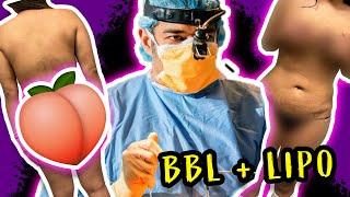 Brazilian Butt Lift Explained! | Liposuction 360 Explained! |