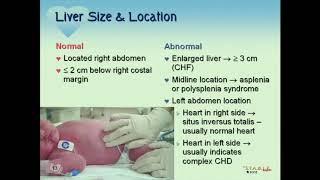 STABLE Cardiac Part I