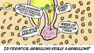 What is periapical granuloma?