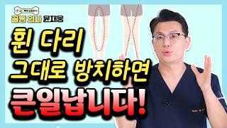 무릎 관절염 유발하는 휜 다리, 이렇게 교정하라! - 골통 의사 윤재웅 #08 휜다리 수술