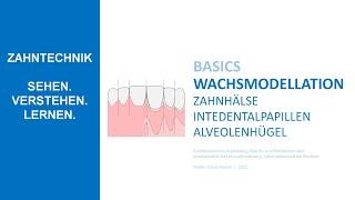 Zahnhals - Interdentalpapille - Alevolenhügel | Wachsmodellation herausnehmbare Prothetik