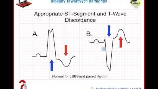 Ekg Podcast 21 of 59. Bloky Tawarovych Ramienok. Part 3