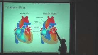 Ontology-based integration and analysis of phenotypes