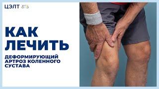  Как лечить деформирующий артроз коленного сустава. Деформирующий артроз коленного сустава. 12+