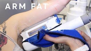 How to reduce arm fat? - Fat Freezing