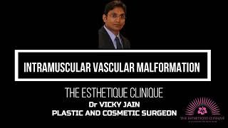 INTRAMUSCULAR VASCULAR MALFORMATION | नस कि गांठ की सर्जरी | PLASTIC SURGEON Dr VICKY JAIN | MUMBAI