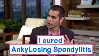 I cured my Ankylosing Spondylitis