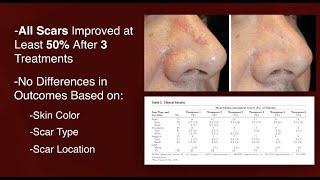 Can Microneedling Improve Scars? Plastic Surgery Hot Topics with Rod J. Rohrich, MD