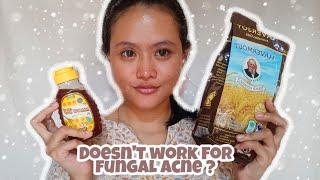 5 days oatmeal & honey mask review on acne prone skin ⎮ English ⎮ Vlog 48