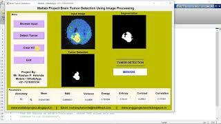 Brain Tumor Detection and Classification Using Image Processing Matlab Project Code