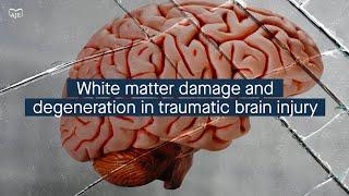 White matter damage and degeneration in traumatic brain injury