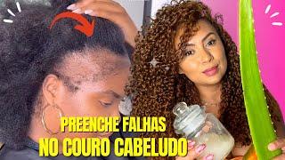 O CABELO CRESCE EM 10 DIAS COM APENAS 2 INGREDIENTES! COMBATE A QUEDA CAPILAR!