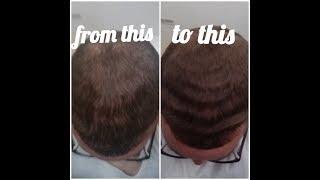 How to get straight hair waves, back and sides tip
