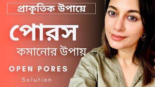 ওপেন পোরস ও লার্জ পোরসের সমাধান, খুব সহজেই মুক্তি পান তেলেতেলে পোরসের হাত থেকে