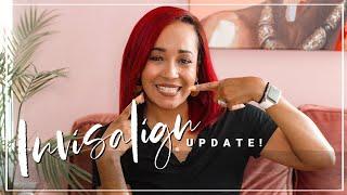 My Invisalign Journey Update - Week 20!  | Kym Yvonne