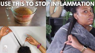 Fight Scalp Inflammation and Hair Loss with this Tea|Ayurvedic Hair Challenge Week 13