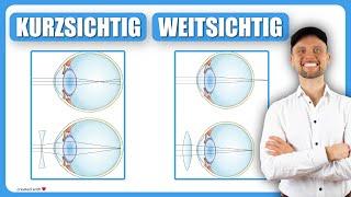 Kurzsichtig (Myopie) und Weitsichtig (Hyperopie) - Optik, Auge