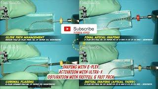 TUTORIAL ENDODONTIC SHAPING E-FLEX ROTARY FILE, ULTRA-X, FAST FILL, FAST PACK EIGHTEETH ️