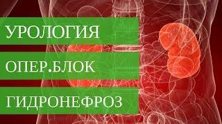 ГИДРОНЕФРОЗ ПОЧКИ - оперирует Стаховский А.Э. Диагностика и лечение патологий почек.