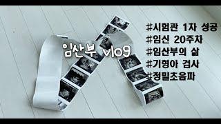 시험관 1차 성공, 임신 20주, 기형아검사, 정밀초음파, 임산부변비, 임산부영양제