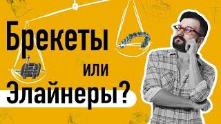 Что лучше БРЕКЕТЫ или ЭЛАЙНЕРЫ? Все ЗА и ПРОТИВ // Ortodony