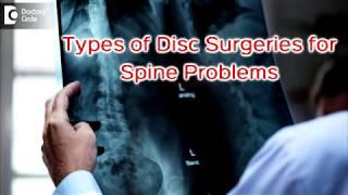 What are different types of surgeries for disc & spine problems? - Dr Arjun Srivatsa