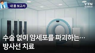 [내 몸 보고서] 수술 없이 암세포를 파괴하는…방사선 치료 / YTN 사이언스