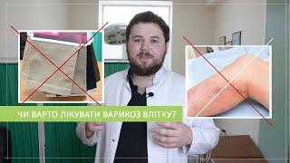 Чи варто лікувати ВАРИКОЗ влітку?