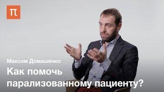 Лечение инсульта и современные технологии— Максим Домашенко