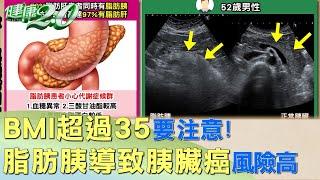 BMI超過35要注意！ 脂肪胰導致胰臟癌風險達46% 健康2.0