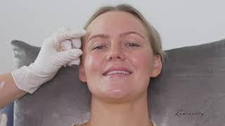 Luminosity Skin Geelong - Cosmetic Injectables Procedure with Caitlyn