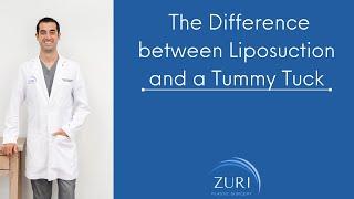 The Difference between Liposuction and a Tummy Tuck