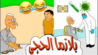 بلازما الحجي      #بيت_أبو_حمودي