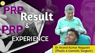 PRP Result | PRP Therapy for Hair Fall | PRP Treatment stop hair fall | Hair Fall Solution |