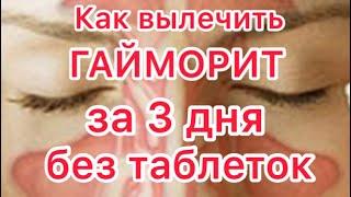 Как вылечить гайморит в домашних условиях/ ПРОВЕРЕНО НА СЕБЕ