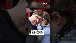 Вместе до конца: умерли старейшие в мире сиамские близнецы